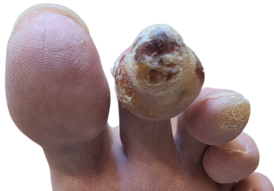 Diabetic_Before_processed