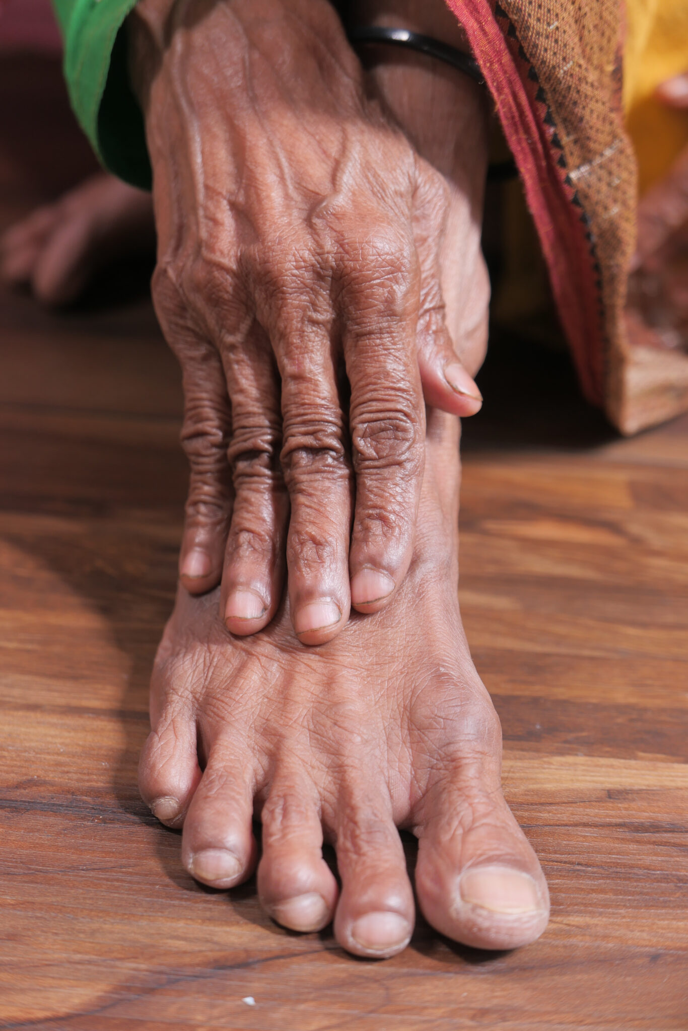 Seniors (Geriatric) Foot Care Ottawa Footopia