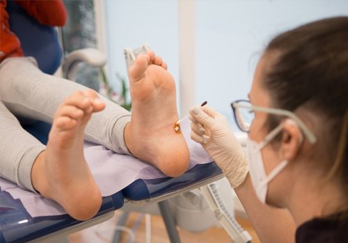 Wound care on a foot ulcer